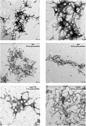 Figure 3. Visualisation of extracted human ATTR-V30M fibrils, immunogold-labelled using isoD38-TTR mAbs 2F2 and 4D4. Transmission electron microscopy reveal the typical long-branched structure of amyloid TTR fibrils (upper panel). 2F2 and 4D4 showing strong labelling of human ATTR-V30M fibrils, indicated by 20 nm gold particles (middle panel). Immunogold labelling with an antibody binding to total-TTR and a non-sense isotype control is shown in comparison (lower panel).