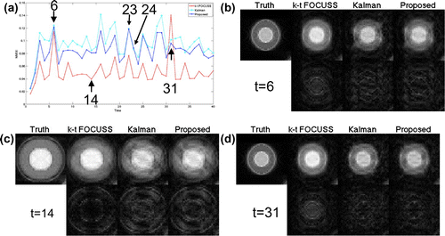Figure 6. The NMSE of the area covering the rapidly oscillating circle (a) and the truth, recovered images and their error maps of k–t FOCUSS, KF and proposed method for frames 6(b), 14(c), 31(d), respectively.