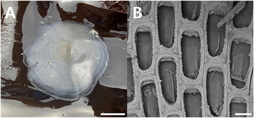 Figure 1. Membranipora villosa. (A) Colony encrusting Saccharina japonica, from kelp farm. (B) Autozooids, bleached, showing serrated lateral borders of cryptocyst and a short, blunt, hollow, spine-like knob at each proximal corner, SEM image, scale bar:1cm (a), 100㎛ (B). Photographs were taken by Geon Woo Noh (SEM image) and Ji Eun Seo (colony).