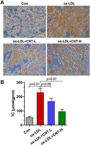 Figure 4 CNT reduced ox-LDL-induced foam cell formation. (A) Representative images of Oil red O staining in ox-LDL-treated RAW264.7 cells. Bar=50 μm. (B) TC contents in ox-LDL-treated cells. Data were expressed as mean ± SD.