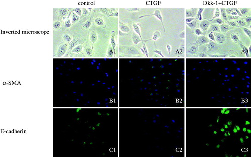 Figure 4. Morphological and phenotypic changes of HK-2 cells cultured under different conditions were determined by immunofluorescence staining under a inverted microscope. The cellular morphology (A1–A3; original magnification ×200) and the expression of α-SMA (B1–B3; original magnification ×400) and E-cadherin (C1–C3; original magnification ×400) are shown, respectively. Left: normal control and middle: HK-2 cells were treated with rhCTGF (50 ng/mL) for 24 h; right: HK-2 cells were pretreated with rhDkk-1 (200 ng/mL) for 1 h and then treated with rhCTGF (50 ng/mL) for 24 h. E-cadherin and α-SMA expression is shown in green. Cells were counterstained with 4,6-diamidino-2-phenylindole dihydrochloride hydrate (DIPA) to demonstrate the nuclei (blue).