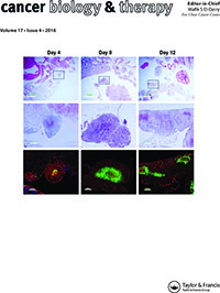 Cover image for Cancer Biology & Therapy, Volume 17, Issue 4, 2016