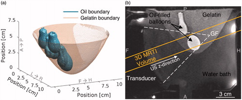 Figure 3. (a) Surface rendering of 3 D breast model used for phase aberration correction. MR coordinate directions are indicated along the axes. (b) Sagittal T1-weighted MR image showing experimental setup and the positioning of oblique 3 D MRTI volume. Dashed lines trace the outer rays from the spherical transducer and converge at the location of the geometric focus as determined by positioning coils.