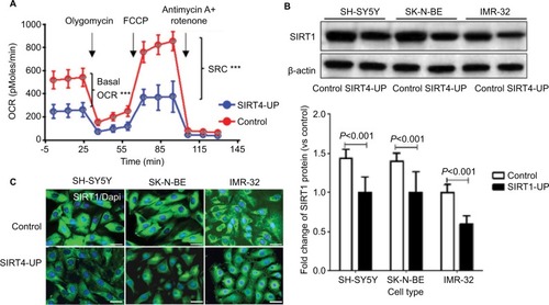 Figure 6 Upregulation of SIRT4 inhibited mitochondrial respiration in neuroblastoma (NB) cells by inhibiting SIRT1 expression.Notes: (A) Basal OCR and mitochondrial SRC of SH-SY5Y cells and SIRT4-UP SH-SY5Y cells were identified by XFe-24 Extracellular Flux Analyzer with XFe24 extracellular flux assay kits. *** P<0.001; (B and C) overexpression of SIRT4 inhibited the SIRT1 protein expression, as detected by Western blot and immunofluorescence. Each experiment was repeated at least three independent times. Scale bars =50 µm. “UP” indicates the gene expression of SIRT4 was up-regulated.Abbreviations: FCCP, carbonyl cyanide-p-trifluoromethoxyphenylhydrazone; OCR, oxygen consumption rate; SRC, spare respiratory capacity.