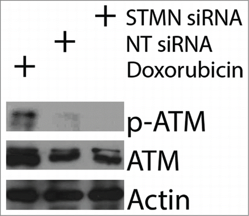 Figure 5. ATM is not activated by stathmin depletion. Hela cell lysates were probed with antibodies to phosphorylated ATM (S1981P) to determine whether stathmin depletion induces a DNA damage response. Phosphorylated ATM was readily apparent in doxorubin treated cells, used here as a positive control. In contrast, stathmin depletion did not lead to detectable ATM activation and did not change total ATM concentration.