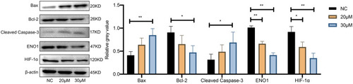 Figure 11 The effect of curcumin on the expression of HIF-1α and ENO1 and apoptosis level in U251 cells confirmed by Western blotting. *P < 0.05 and **P < 0.01.