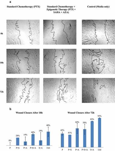 Figure 5. Effects of PTX and PTX with epigenetic treatments on wound closure in a scratch assay. A. Fibroblast scratch assays were incubated in conditioned media from ASCs (ASC1) treated with drugs. A. Wound closures for each treatment also are photographed at 5x magnification. B. Wound closure was measured after 18 h and 72 h. (N = 3).