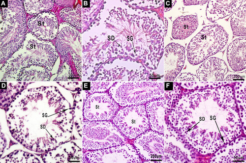 Figure 7 Testicular cross-sections of mice, stained with H&E. (A) Testis section of the NC60 group, showing the normal histological structure of seminiferous tubules (St) containing spermatocytes and late spermatids in the lumen, X100: bar, 200 μm. (B) At higher magnification, the seminiferous epithelium consisting of spermatogonia (SG), spermatocytes, and spermatids (SD) can be observed clearly, X400: bar, 50 μm. (C) Testis section of the MSG60 group. The arrangement of seminiferous tubules is loose and scattered, part of the lumen is closed, and the structure is unclear, X100. (D) At higher magnification, the spermatogenic epithelium is thin, the interstitial staining is unclear, the production of sperm cells and mature sperm in the lumen is less, the tail of the sperm is unclear, the spermatogenic cells in the tube wall are mainly spermatogonia (SG) and spermatocytes, and the cytoplasmic staining is uneven, X400. (E) Testis section of the MSG90 group, X100, and higher magnification (F), X400. The structural morphology is the same as the MSG60 group: bar, 50 μm.