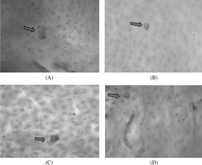 Figure 3 Cultures (21 days) of monocytes incubated on bovine cortical slices in the presence of (A) 25 ng/ml M-CSF and 30 ng/ml sRANKL, (B) 25 ng/ml M-CSF and 10−7 M LTB4, (C) 25 ng/ml M-CSF and 10−8 M LTB4, (D) 25 ng/mlM-CSF and 10−9 M LTB4. After removing adherent osteoclasts, the bovine cortical slices were stained with toluidine blue showing resorption pits (original magnification ×200).