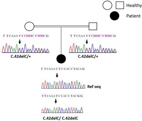 Figure 1 Sanger sequencing results: electropherograms of the affected patient and her parents. (+) indicated the wild type allele. The position of the mutation is indicated by the arrow.
