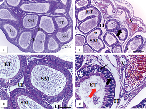 Figure 3. Photomicrographs of epididymal sections from normal males and quinestrol-treated males of Nile rats stained with H&E. Normal males: (a) and (b) show epididymal tubules (ET) lined by pseudostratified columnar epithelium (PE) and filled with spermatozoa (SM) in their lumina. There are narrow interstitial spaces between the ducts (IT). Quinestrol-treated males: (c) and (d) show shrunken epididymal ducts (ET) lined by pseudostratified columnar epithelium (PE). There are wide interstitial spaces between the ducts (IT), that are filled with cellular debris (star), a few spermatozoa are present (red arrow), along with vacuolated epithelial cells (thick arrow), some pyknotic nuclei (thin arrow), and vascular congestion (V).