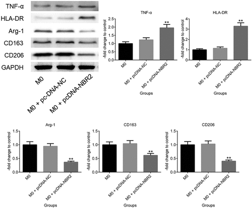 Figure 2. The expression level of TNF-α, HLA-DR, Arg-1, CD163, and CD206 in macrophages was determined by western blot (**P < 0.01, vs. M0)