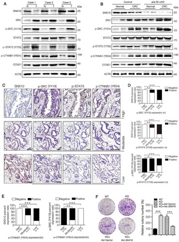 Figure 3. SNX10 deficiency enhances the activation of SRC-mediated STAT3 and CTNNB1 signaling in tumors and promotes colon cancer cell proliferation and survival. (A) Representative immunoblots of indicated proteins in tumor tissues (T) and paired adjacent normal tissues (N) of CRC patients. (B) Representative immunoblots of indicated proteins in normal colorectal epithelium and CRC tissues from control and snx10-cKO mice. (C–E) Representative IHC images of SNX10, p-SRC (Y419), p-STAT3 (Y705) and p-CTNNB1 (Y654) in human CRC tissues, and the clinical relevance of the expression of indicated proteins in human CRC tissues. Scale bar: 100 μm. (F) The colony-forming ability of WT, SNX10 knockout Caco-2 cells and SNX10 knockout Caco-2 cells infected with Ad-vector or Ad-SNX10. Right panel: Quantification of colony numbers. Data are represented as mean ± SEM. *, p < 0.05; **, p < 0.01; ***, p < 0.001; by Fisher’s exact test (D and E) and 2-tailed, unpaired t-test (F).