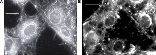 Figure 3 Light darkfield images of RG2 glioma cells before (A) and after (B) exposure to 5 nmol/L of zinc nanoparticles (Bar, 10 μm).