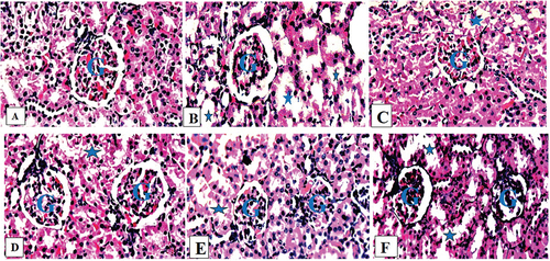 Figure 5. Composite photomicrographs of kidney of control (a) showing a normal glomerulus (G) and renal tubules, HgCl2 treated micrograph (b) exhibited degenerated renal tubules (Asterix), with a mild retracted glomerulus (G), Extract 25 mg/kg + 0.5 mg/kg HgCl2 (c) showed a mild obliterative form glomerular space (G) with mild degenerated renal tubule (Asterix), Extract 50/75 mg/kg + 0.5 mg/kg HgCl2 (d & e) showing very normal rental tubules (Asterix) and a normal glomerulus (G), Ascorbic Acid treated group (f), exhibited mild obliterative form of glomerulus (G).