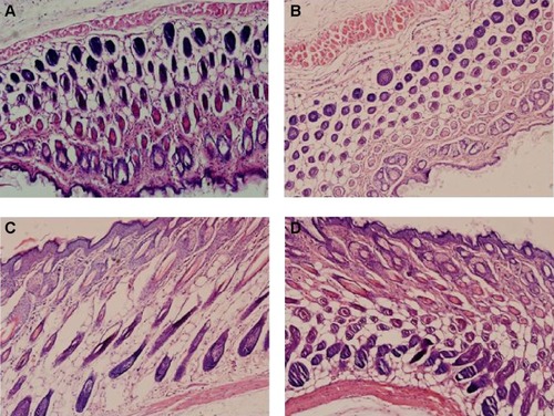Figure 9 Microscopic photographs of rat skin after treatment of cubosomes and cream (×100).