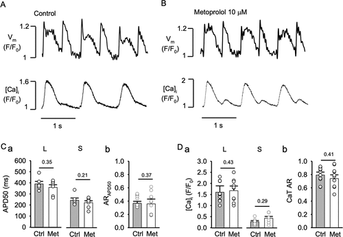 Figure 6. Metoprolol does not modify APD or CaT alternans. Vm and [Ca]i traces from atrial myocytes in control (A) and during metoprolol (10 µM) treatment (B). APs and CaTs were elicited by field stimulation at 2 Hz. C, Mean APD50 of long (L; control vs. metoprolol: P = 0.35, n = 11) and short (S; P = 0.21) APs during alternans (panel a) and average ARAPD50 (panel b) in control and metoprolol (Met; P = 0.37, n = 11). D, average CaT amplitudes of large (L: control vs. metoprolol, P = 0.43) and small (S; P = 0.29) amplitude alternans CaTs (panel a) and average CaT AR (panel b) in control and metoprolol (P = 0.41). Statistical analysis with unpaired t-test.