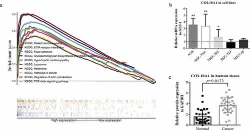 Figure 3. GSEA analysis and experimental verification. (a) A combined enrichment plot has been obtained from the analysis of the enrichment of the gene series, including the enrichment fraction and gene series (top 10 terms). (b) The expression level of COL10A1 was higher than that of GES-1 in three kinds of GC cells (AGS, SGC-7901 and MGC-803) (*P < 0.05, **P < 0.01). (c) qRT-PCR analysis of COL10A1 mRNA expression in 30 pairs of GC tissues and adjacent nontumor tissues