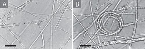 Figure 1. Tuber rugosum growth in vitro shown on the pH 7.0 adjusted medium containing 1.0 mL/L biotin as described in Materials and Methods. A. A typical right-angled hyphal branch with simple septa. B. A hyphal coil that is seen regularly on surface growth in cultures as they age. Bars = 20.0 μm.