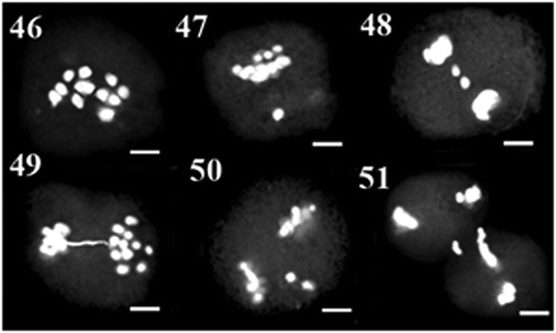 Figure 46–51. Meiosis in AZE36 population: 46: diakinesis; 47: metaphase I with precocious chromosome; 48: anaphase I with laggard chromosome; 49: anaphase I with bridge; 50: metaphase II with fragment chromosome; 51: cytomixis. Scale bars: 5 μm.