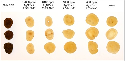 Figure 3 Staining effect on tooth slices treated with fluoridated PEG-AgNPs, NaF, SDF, and water.