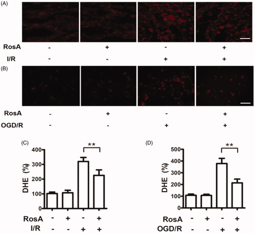 Figure 6. Effects of RosA on ROS production. (A) Representative micrograph of RosA reducing ROS production in myocardial I/R area. Scale bar, 100 μm. (B) Representative micrographs of RosA reducing ROS production after OGD/R injury in cells. (C) Statistical results of RosA reducing ROS production in myocardial I/R area. (D) Statistical results of RosA reducing ROS production after OGD/R injury in cells. Data are expressed as the mean ± S.D. (n = 3). Significance was determined by ANOVA followed by Tukey’s test. **p < 0.01 vs. Vehicle + I/R or Vehicle + OGD/R.