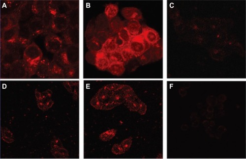 Figure 5 Liposomes encapsulating mitoxantrone uptake in various cell lines followed by confocal laser scanning fluorescence microscopy. Cell lines were treated with either LHRH-MTX-SL or MTX-SL for 4 hours at 37°C. (A) LHRH-MTX-SL in LHRH receptor high-expressing MCF-7 cells; (B) MTX-SL in LHRH receptor high-expressing MCF-7 cells; (C) MCF-7 cells treated with drug-free medium used as a control; (D) LHRH-MTX-SL in LHRH receptor low-expressing SK-OV-3 cells; (E) MTX-SL in LHRH receptor low-expressing SK-OV-3 cells; (F) SKOV-3 cells treated with drug-free medium used as a control.Note: Copyright © 2010. Reproduced with permission of Dove Medical Press. He Y, Zhang L, Song C. Luteinizing hormone-releasing hormone receptor-mediated delivery of mitoxantrone using LHRH analogs modified with PEGylated liposomes. Int J Nanomedicine. 2010;5:697–705.Citation108Abbreviations: LHRH, luteinizing hormone releasing hormone; MTX, methotrexate; SL, loaded liposomes.