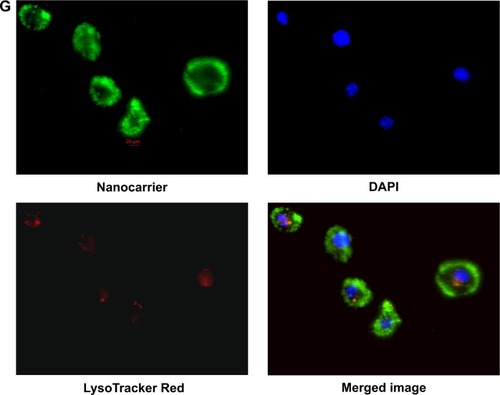Figure 7 PCL, polycaprolactone; MD, maltodextrin (A–G) subcellular localization of PCL/MD in PC3 with time (0 minute, 5 minutes, and 30 minutes and 1 hour, 2 hours, 6 hours, and 12 hours): acidic organelles (lysosome-LysoTracker Red), nuclei (DAPI), and cytoplasm in PC3.Abbreviations: PCL, polycaprolactone; MD, maltodextrin; DAPI, 4′,6-diamidino-2-phenylindole.
