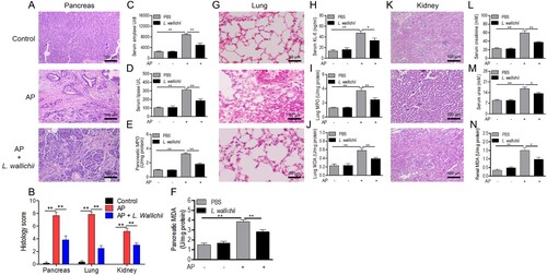 Figure 1. L. wallichii extracts attenuated pancreatic, lung, and renal damage in caerulein-induced rats. (A) H&E staining of pancreas tissue from each group showed different levels of tissue damage including pancreatic edema, extravascular infiltration and acinar cell necrosis (×100). (B) Histologic inﬂammatory score of (A), (G), and (K). (C and D) The activity of serum amylase (C) and lipase (D) in each group (n = 6 per group). (E) Quantification of MPO activity in the pancreas tissues of each group. (F) Quantification of MDA content in the pancreatic tissues of each group. (G) H&E staining of lung tissue from each group presented different levels of tissue damage including thickening of the alveoli, neutrophil infiltration, and alveolar congestion (×200). (H) The level of serum KL-6 in each group (n = 6 per group). (I) Quantification of MPO activity in the lung tissues of each group. (J) Quantification of MDA content in the lung tissues of each group. (K) H&E staining of kidney tissue exhibited identifiable features of kidney injury including typical histological signs of glomerular and tubular damage. (×100). (L, M, and N) Quantification of serum creatinine (L), urea (M) and renal MDA (N) from each group (n = 6 per group). Mean ± SEM, *p < 0.05, **p < 0.01.