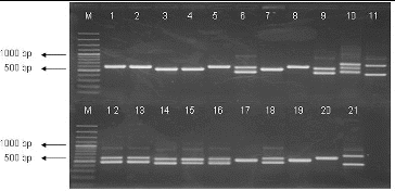 Figure 1. PCR-amplification of 16S-23S ITRs (16S-4/23S-7 primers) of LAB strains. Lane 1: strain P3/3, lane 2: P3/4, lane 3: P3/5, lane 4: L. lactis 454, lane 5: P3/8, lane 6: P3/9, lane 7: P4/1, lane 8: P4/8, lane 9: P4/9, lane 10: P4/11, lane 11: P1/30, lane 12: P2/4, lane13: Enterococcus faecium, lane 14: P2/18, lane 15: P2/19, lane 16: P2/24, lane 17: P4/6, lane 18: P2/32, lane 19: P4/2, lane 20: Ln mesenteroides ATCC 8293 and lane 21: L. plantarum NBIMCC 297, M-molecular weight marker (100-bp DNA ladder, Fermentas).