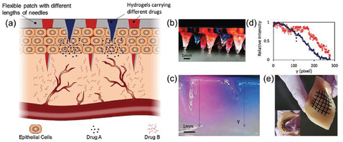 Figure 3. Images of the miniaturized needle arrays for the enhanced bioavailability of drugs at the desired tissue depths with (a) depicting a schematic representation of the MNA-based dressing for the delivery of two different therapeutics targeting different depths or regions of the tissue to target separate cell populations, (b) a typical 3D-printed multilength needle array, in which the needles of different lengths were filled with hydrogels carrying different agents (shown with different colors), (c) the qualitative and (d) the quantitative distribution of different dyes in an agarose skin model released from the multilength MNA bandage with (e) the compliance of the semiflexible MNA on a sample of pig skin (reproduced with permission from [Citation97]).