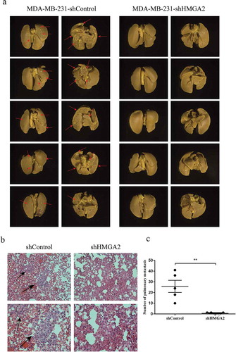 Figure 8. HMGA2 depletion suppresses metastasis in amouse xenograft model