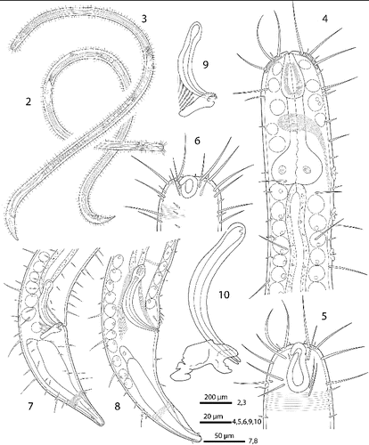 Figs. 2–10. Robbea hypermnestra sp. nov. 2. Female, whole; 3. Male, whole; 4. Male, anterior body region; 5. Male, head, surface view; 6. Female, head, surface view; 7. Female, tail; 8. Male, tail (gubernaculum not drawn); 9. Female, spiculum; 10. Male, spiculum.