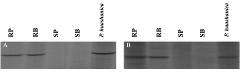 Fig. 4 STS markers STSM4 (A) and STSM5 (B) amplified in cultivars, H9015-17–1-9–6 (RP), resistant bulk (RB), susceptible parent (SP, Mingxian169), susceptible bulk (SB) and Psathyrostachys huashanica.