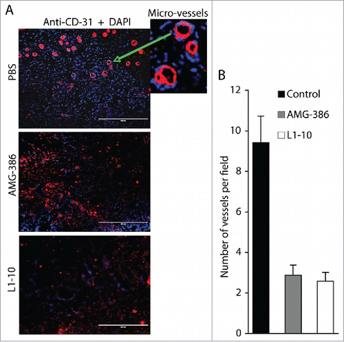 Figure 7. AMG-386 and L1-10 inhibit tumor angiogenesis. A, IFA staining of tumor sections from mice treated with placebo (PBS), AMG-386, and L1-10 with an antibody to mouse CD31 as described in Figure 3B. DAPI was used for nuclear staining of all cells. Enlarged representative blood vessels were indicated with an arrow. B, average numbers of vessels per field (10× magnification) from 4 fields per tumor and 8 tumors per group. Significant differences are seen between tumors from mice treated with PBS and those treated with AMG-386 or L1-10, with P values smaller than 0.05.
