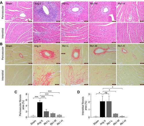 Figure 2 Rb1 alleviates cardiac fibrosis in Ang II–infused mice. C57BL/6J mice were subcutaneously infused with Ang II (1 μg/kg/min) or saline (sham) for 14 days. Ang II–infused mice received daily treatment of either vehicle (Ang II) or Rb1 at 6.25 mg/kg (Rb1-L), 25 mg/kg (Rb1-M) and 100 mg/kg (Rb1-H). (A) Cardiac morphology was examined by H&E staining of paraffin-embedded heart sections. Scale bar, 50 μm. (B) Picrosirius Red staining was performed to visualize the collagen fibers in the heart sections. Scale bar, 50 μm. Perivascular (C) and interstitial fibrosis area (D) was measured in Picrosirius Red-stained heart sections (n=5 per group). Data were expressed as mean±S.E.M. * P<0.05, *** P<0.001.