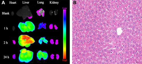 Figure 10 (A) Fluorescence images of organs at 1 h, 2 h, and 24 h after CU1-LSLN was injected into tail vein. (B) H&E staining of liver.