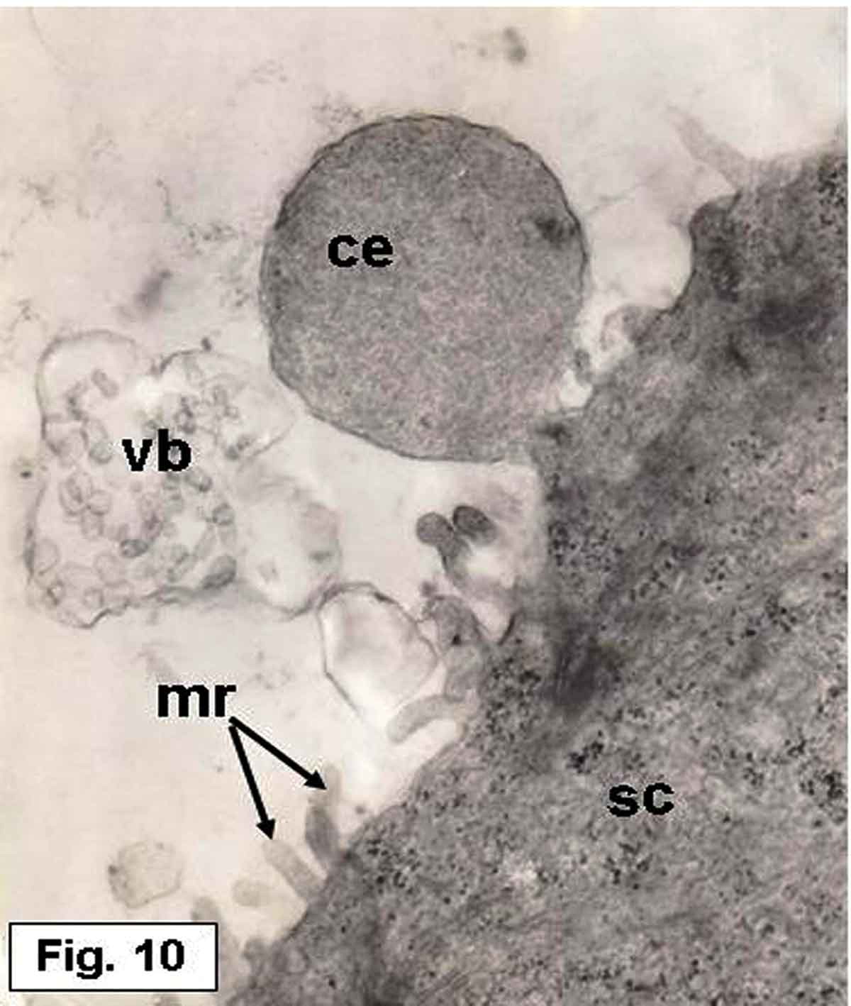 Figure 10. Hypophthalmichthys molitrix, 7 days after hatching. TEM micrograph of the saccular sensory epithelium, showing cytoplasmic extrusion (ce) projecting from supporting cell (sc) and still in contact with its apical surface. Secretory materials, as vesicular bodies (vb) containing small spherules, seemed to be librated from supporting cell. Note the microridges (mr) of the supporting cell. 17,000×.