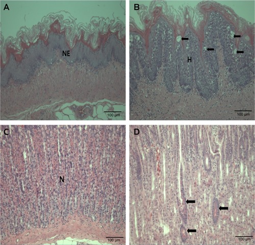 Figure 3 Histopathological findings of limiting ridge and glandular stomach.Notes: (A) Normal limiting ridge of the stomach of a male Sprague Dawley (SD) rat administered 0 mg/kg zinc oxide (ZnO) nanoparticles. Note the normal epithelium (NE) in the forestomach. (B) Squamous cell hyperplasia (H) and squamous cell vacuolation (arrows) in the limiting ridge of the forestomach of an SD rat administered 500 mg/kg ZnO by gavage for 90 days. Note the squamous cell hyperplasia (H) in the forestomach. (C) Normal glandular stomach of a male SD rat administered 0 mg/kg ZnO by gavage for 90 days. Note the normal mucosa (N) in the glandular stomach. (D) Eosinophilic chief cells (arrows) in the glandular stomach of a male SD rat administered 500 mg/kg ZnO by gavage for 90 days. Scale bar: 100 mm; hematoxylin and eosin staining.