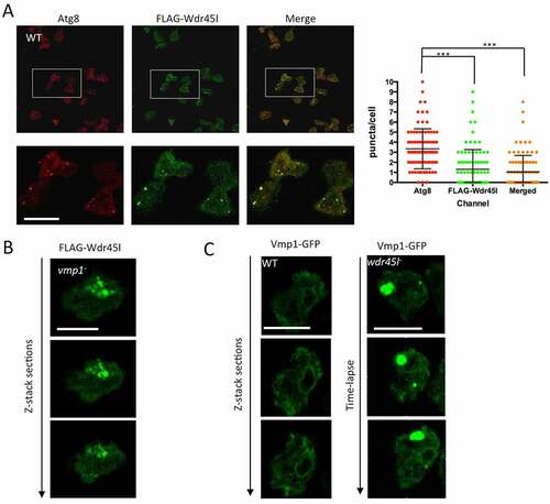 Figure 7. Subcellular localization of Wdr45l.