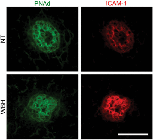 Figure 3. Fever-range thermal stress increases ICAM-1 display on HEVs of peripheral lymph nodes. Intravascular staining of ICAM-1 (red) and PNAd counterstaining (green). Bar = 50 µm.