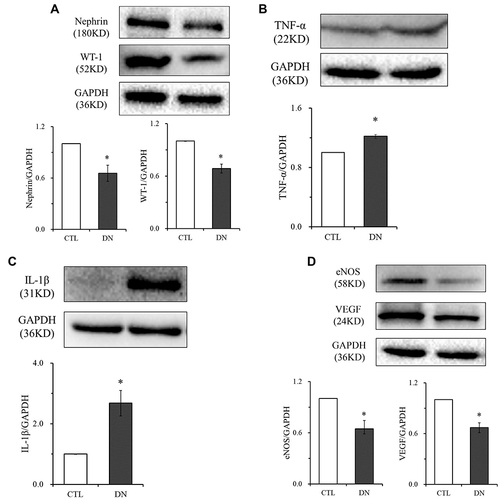 Figure 7 Comparison of Nephrin, WT-1, TNF-α, IL-1β, eNOS and VEGF protein expression levels of kidney. (A) Nephrin and WT-1 expressions. (B) TNF-α expressions. (C) IL-1β expressions. (D) eNOS and VEGF expressions. Data are expressed as the mean ± standard deviation (n=6). *P < 0.05, vs the CTL group.