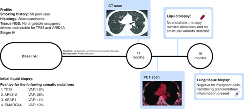 Figure 1. Timeline of the patient.At baseline, no targetable mutations, but liquid biopsy detected TP53, ARID1A, KEAP1 and SMARCA4 mutations. After complete response, at 14 months, a solitary pulmonary nodule was detected on CT, and it was PET avid indicative of potentially acquired resistance to PD-1 therapy. Liquid biopsy detected clearance and was inconsistent with radiology. Further investigation with tissue biopsy at 16 months revealed a benign diagnosis and refuted the progression of the disease.