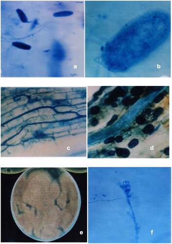 Figure 1. Eggs of M. incognita with fungal mycelium (a &b); Colonization of R. fasciculatum in the root cortical cells of C. annuum (c) and showing variously shaped intracellular vesicles of R. fasciculatum (d); Isolated egg parasite from rhizosphere of Capsicum annuum (e); Conidiophore of Paecilomyces lilacinus showing conidia in chain(f).