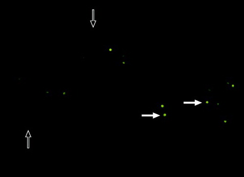 Figure 2.  Chromomycin A3 (CMA3) staining. Dull sperm cell heads shown with hollow arrows were scored as CMA3 negative cell and bright yellow sperm cell heads shown with bold arrows were scored as CMA3 positive cell.