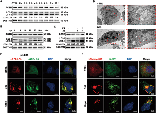 Figure 2. S. pneumoniae infections induced autophagy in A549 cells. (A and B) WB analysis of the LC3 and SQSTM1 protein expressions in A549 cells in response to the infection of 50 moi of D39 at the respective time points (1, 2, 3, 4, 5, 6, 8, and 10 hpi). (C) A549 cells were infected with D39 (moi of 50 at 4 hpi) in the presence or absence of CQ (50 μM, 3 h) before LC3 and SQSTM1 WB analysis. (D-F) A549 cells were infected by 50 moi of D39 for 4 h, followed by fixation and imaging preparation. (D) the visualization of the ultrastructure of A549 cells via TEM. In the images, membrane-like vesicles in D39-infected cells were observed. Arrows indicated membrane-like autophagosomes and autolysosomes. Scale bars: 2 μm, 500 nm. (E) immunofluorescence microscopy visualization of LC3 puncta in D39-infected A549 cells. Confocal images of ptfLC3-transfected A549 cells were infected with D39 or treated for 12 h with 100 nM rapa. Scale bars: 10 μm. (F) images of mCherry-LC3 fluorescent dots (red), FITC-LAMP1 fluorescence (green), and the overlay with DAPI (blue), which shows colocalization of mCherry- and FITC-positive puncta. The rapa-treated group was set as the positive control. Scale bars: 10 μm.