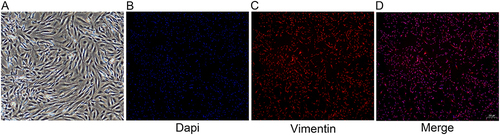 Figure 4 Skin fibroblast morphological identification. (A) SD rat primary skin fibroblasts under bright field of, bar=100um; (B–D) Immunofluorescence verification of SD rat primary skin fibroblasts, bar=200um.