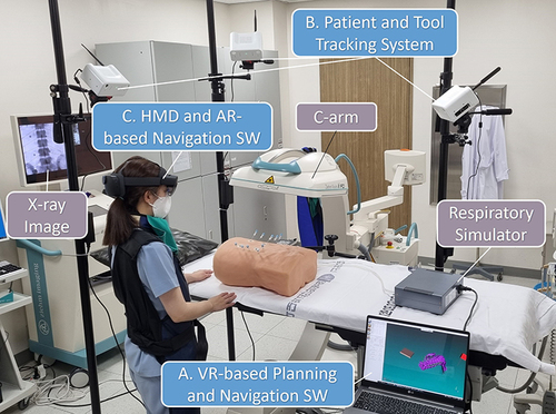 Figure 1 Components of augmented reality (AR)-assisted navigation system. (A) An AR-assisted navigation system for transforaminal epidural injections consists of planning and navigation software, (B) a patient and tool tracking system, and (C) an AR-based navigation system.