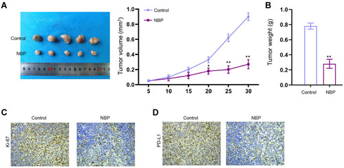 Figure 2 NBP inhibits lung cancer cell growth in vivo. (A–D) The nude mice were injected with A549 cells and treated with NBP. The cell growth of was analyzed by tumorigenicity analysis in the nude mice. (A) The tumor volume was calculated. (B) The tumor weight was calculated. (C) The levels of Ki-67 were detected by IHC. (D) The expression of PD-L1 was tested by IHC. N=5, mean ± SD. *P < 0.05, **P < 0.01.