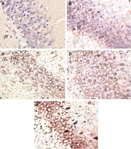 Figure 8 Effects of CTS/PL/β-CD microspheres on the quantities of PKC-δ in the hippocampus by immunohistochemistry staining (light microscope, ×400).